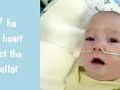 Congenital Heart Defect Congenital Diaphragmatic Hernia Omphalocele