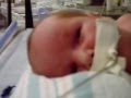 Congenital Heart Defect Congenital Diaphragmatic Hernia Omphalocele