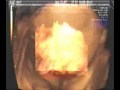 Ecografia 4d con Radiohead
