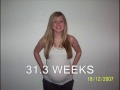 9 Months of Pregnancy +10 Weeks Postpartum Time Laspe