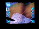 Trauma Center X5: Pempti with two styli