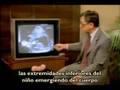 Aborto 2