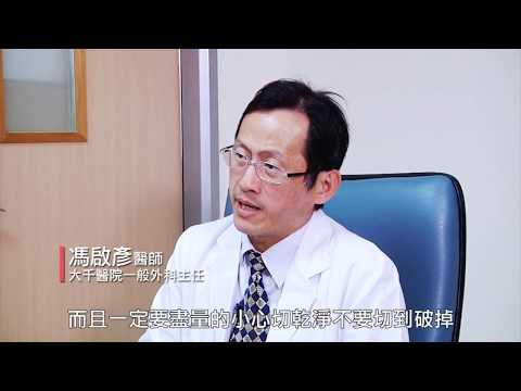 無聲無息的腸胃道基質瘤 兩公分以上變癌率大增!馮啟彥醫師為您解析