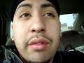 Gall Bladder Advice