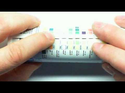 how to read urinalysis
