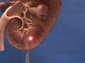 Kidney Model - Cortex & Medulla.avi
