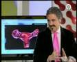 Canal 9 Endometriosis
