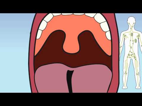 how to locate lymph nodes in the groin