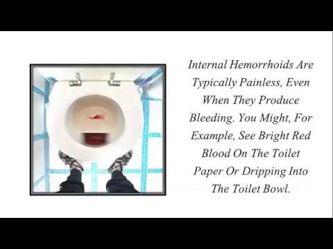 how to relieve rectal burning