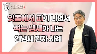 잇몸출혈과 고기 썩는 냄새