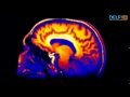 Peržiūrėti Video
