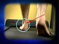 Archillies Tendonitis www.footkneepain.com.au