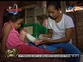 Magulang ng batang nalapnos ang buong kaliwang paa, nananawagan ng tulong medikal