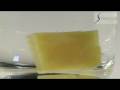 Synetica is a flexible easy-to-use beauty system, for non-invasive treatment and reduction of aberrant adipose tissue. Designed and manufactured for the most advanced medical and beauty centers, Synetica generates constantly calibrated and synchronized ultrasounds (esclusive digital system Synchro-ORE) that, applied from the skin surface, yield a fat reduction through the cavitational effect induced into the adipose layer underneath the derma. Cavitational effect makes fat clumps weaker, more easily released outside the adipose tissue and very quickly excreted from the body. TriWorks is proud now to offer the most advanced instrument of its class for the treatment of aberrant adipose tissue.