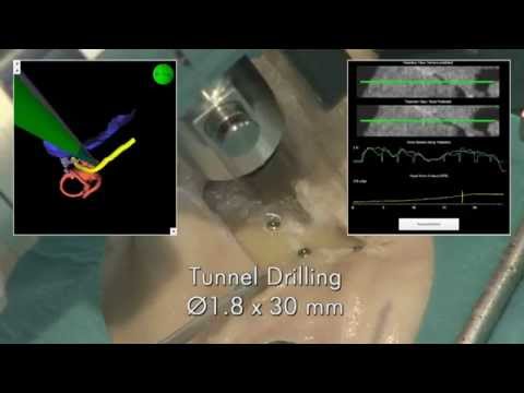 how to help implantation