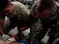 FAST1 Removal