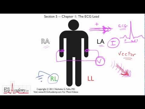 how to apply ecg electrodes