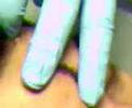 spider bite (part 2)