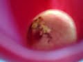 Carnivorous plants-(befor eating locust)-Nepenthes Carnivorous plants-(befor eating locust)-Nepenthes