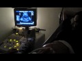 29 Week Ultrasound