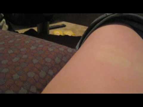 how to administer hcg trigger shot