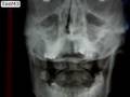 Personal TeleRadiology