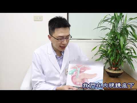 免開刀膽管內視鏡取石新技術