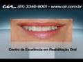 12-Levantamento-de-S