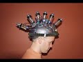 fetal-alcohol-syndrome.html