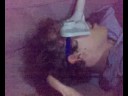 Elephant Man