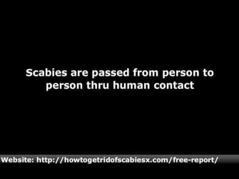 how to get rid scabies