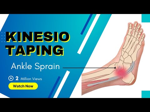 how to relieve sprained ankle pain