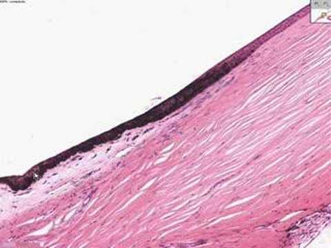 Youtube - Video: Histolog�a - Ojo