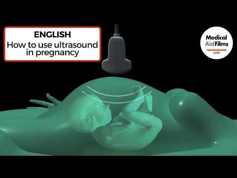how to measure afi ultrasound