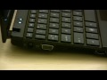 HP Mini 5101 Netbook