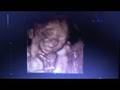 ecografia morfologica in 4d