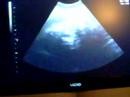 Baby Milloy 29 Week Ultrasound!