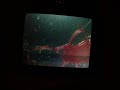 morgellons-chin-hair-with-tube-part-1-10x-60x-200x-mag.html