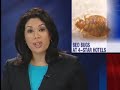 bed bugs in four star hotel
