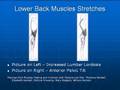 Posture Exercises - Lower Back Stretches