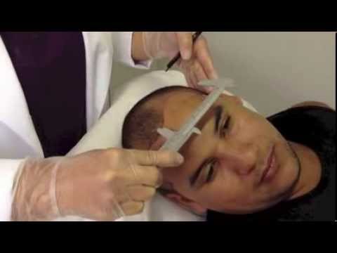 Curso de Micropigmentação Capilar - Wendy Brasil - Rj (21) 2446-6111