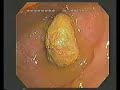 Dr. Shinya - intestino - dublado em portugu�s