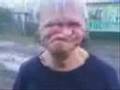 No Teeth