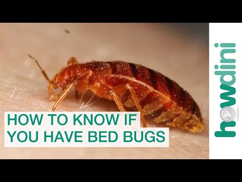 how to know if u have bed bugs