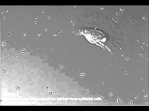 how to isolate epithelial cells