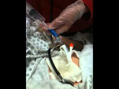 how to unclog a g-j tube