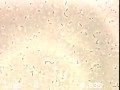 Pseudomonas aerug 1000x motile