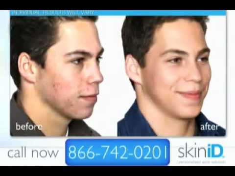 how to buy skin id