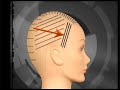The uses of the High Low Lighting technique is extensive in professional haircoloring. Master haircolorist Andre Nizetich points out how High Low lighting can be used ti enhance a overly blonde and can be used to aid in the growing out process. No professional haircolorist can afford to be without this valuable technique.