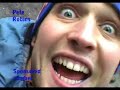 Thumbnail #1